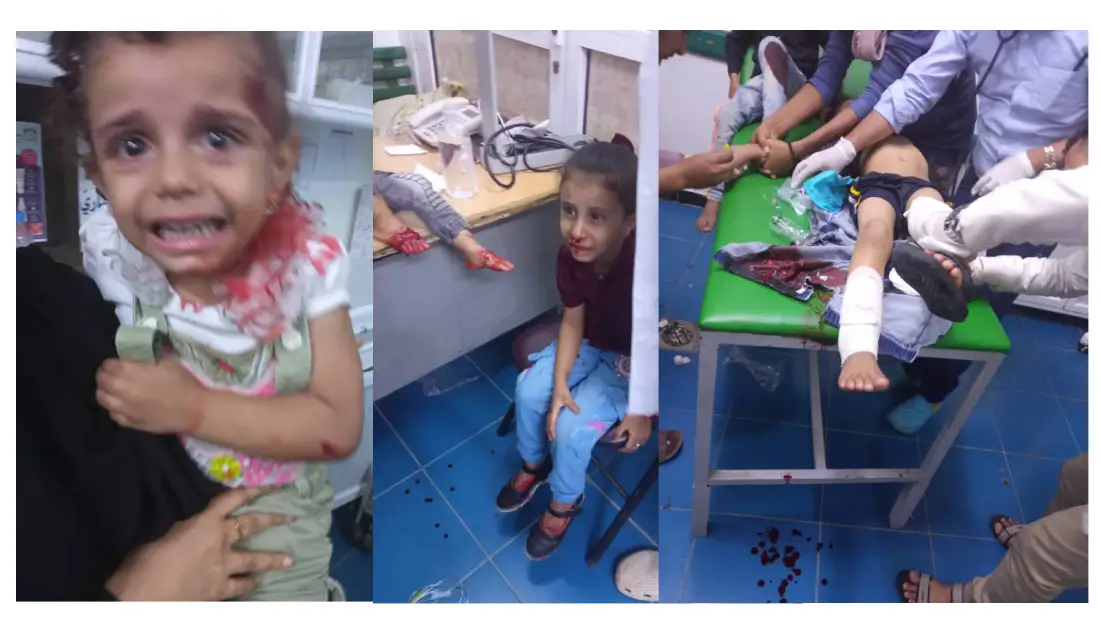 11 children injured in shelling of Houthi militias on Taiz neighborhood: